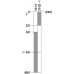 3SE5122-0BC02